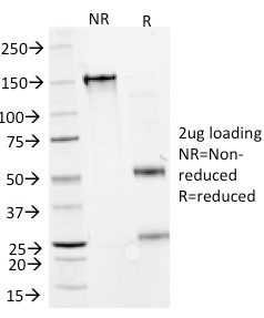Data from SDS-PAGE analysis of Anti-GAD1 antibody (Clone GAD1/2391). Reducing lane (R) shows heavy and light chain fragments. NR lane shows intact antibody with expected MW of approximately 150 kDa. The data are consistent with a high purity, intact mAb.